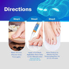 Nail Fungus Repair Pen – Antifungal Herbal Essential Oil Treatment | 4-Pack